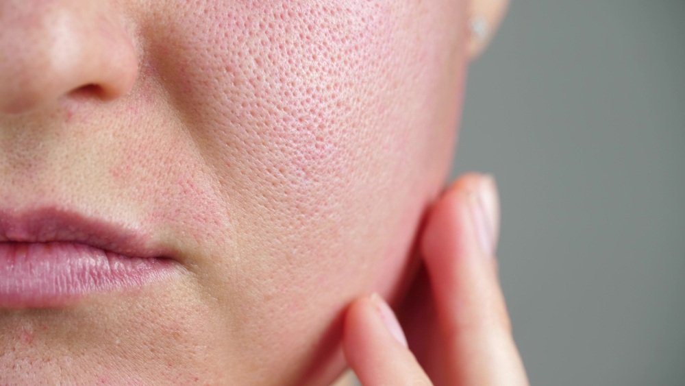 How to Get Rid of Large Pores on the Face